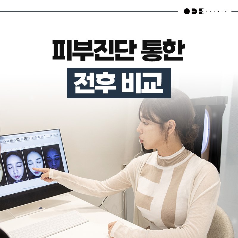 강남리프팅후기좋은곳