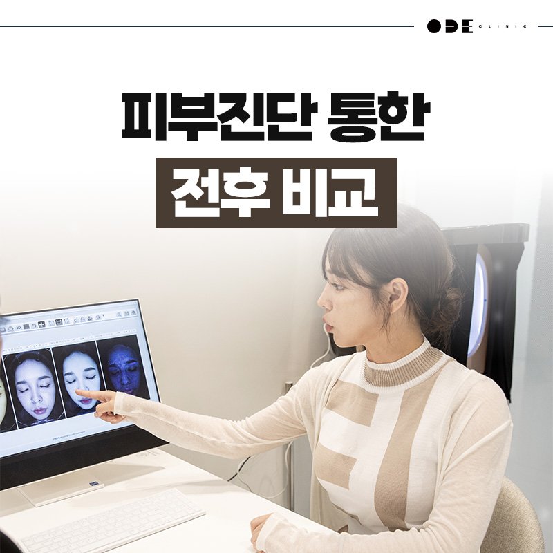 강남세르프통증적은피부과